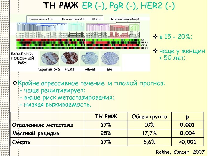ТН РМЖ ER (-), Pg. R (-), HER 2 (-) v в 15 -