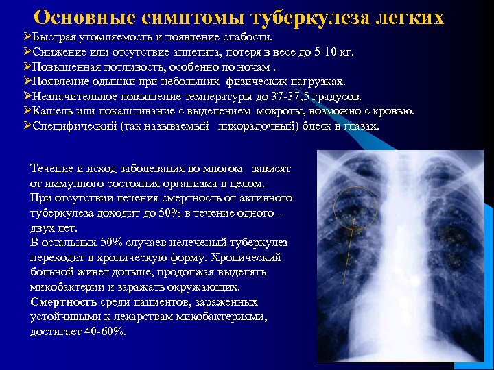 Основные симптомы туберкулеза легких ØБыстрая утомляемость и появление слабости. ØСнижение или отсутствие аппетита, потеря