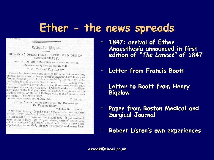 Ether - the news spreads • 1847: arrival of Ether Anaesthesia announced in first