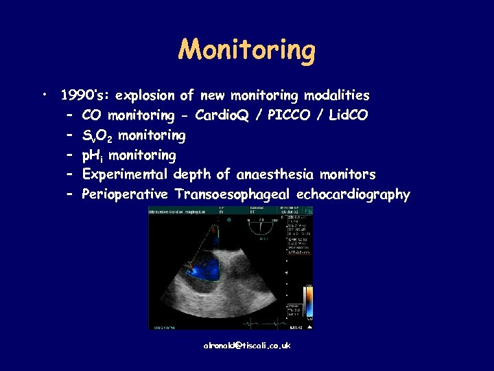 Monitoring • 1990’s: explosion of new monitoring modalities – CO monitoring - Cardio. Q