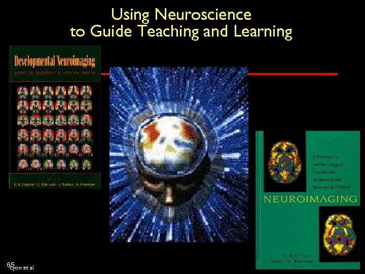 Using Neuroscience to Guide Teaching and Learning 65 et al Lyon 