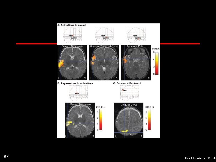 67 Bookheimer - UCLA 