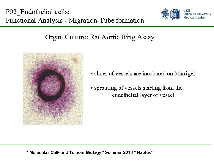 P 02_Endothelial cells: Functional Analysis - Migration-Tube formation Organ Culture: Rat Aortic Ring Assay