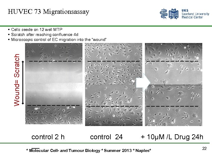 HUVEC 73 Migrationsassay Wound= Scratch § Cells seede on 12 well MTP § Scratch