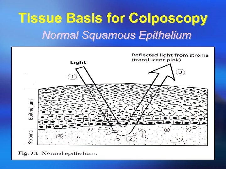 Tissue Basis for Colposcopy Normal Squamous Epithelium 