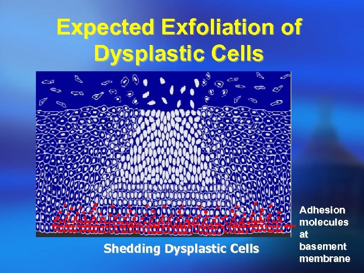 Expected Exfoliation of Dysplastic Cells Shedding Dysplastic Cells Adhesion molecules at basement membrane 
