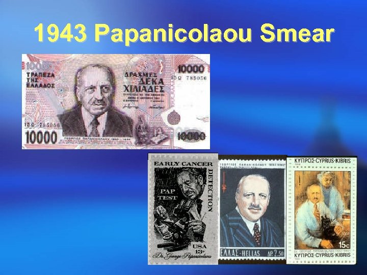 1943 Papanicolaou Smear 