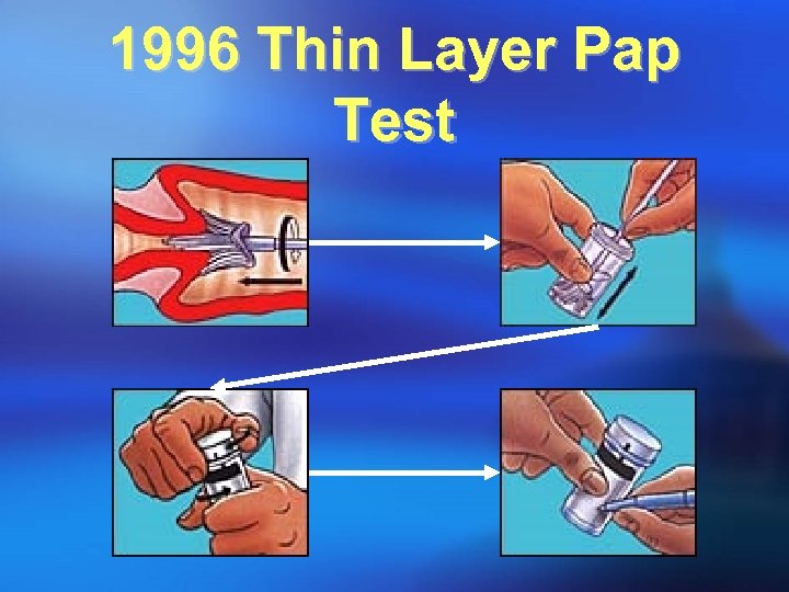 1996 Thin Layer Pap Test 