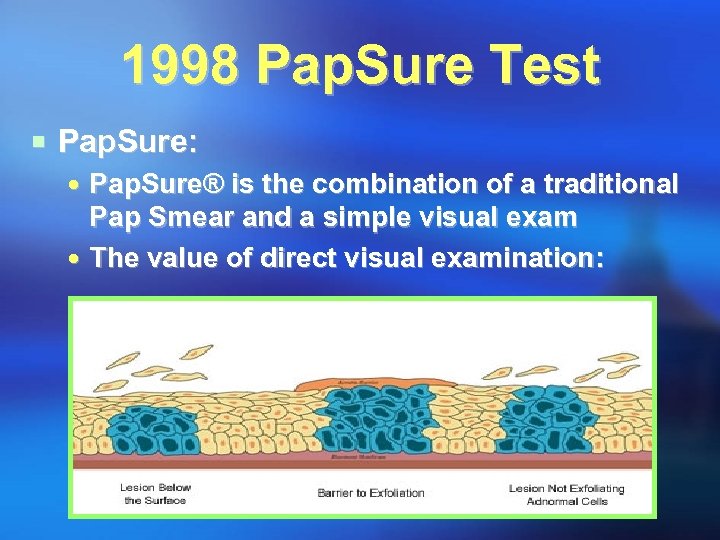 1998 Pap. Sure Test ¡ Pap. Sure: Pap. Sure® is the combination of a