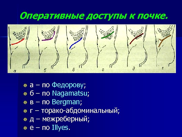 Оперативный топографический анатомия. Оперативные доступы к почкам и мочеточникам. Внебрюшинные доступы к почкам. Оперативные доступы к почке. Хирургические доступы к почкам.