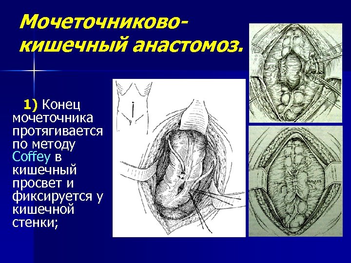 Клитор анатомия картинка