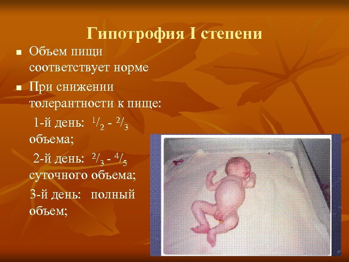 Гипотрофия І степени n n Объем пищи соответствует норме При снижении толерантности к пище:
