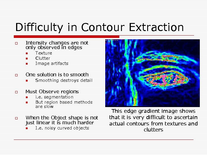 Difficulty in Contour Extraction o Intensity changes are not only observed in edges n