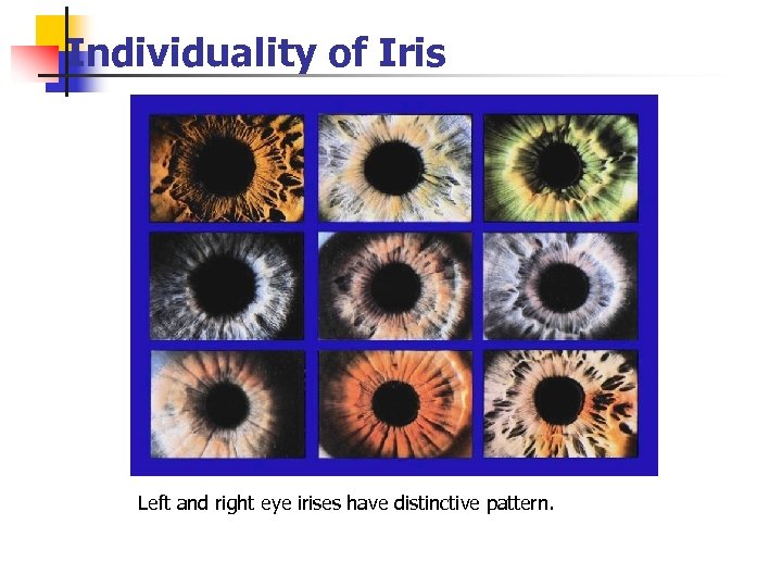 Individuality of Iris Left and right eye irises have distinctive pattern. 