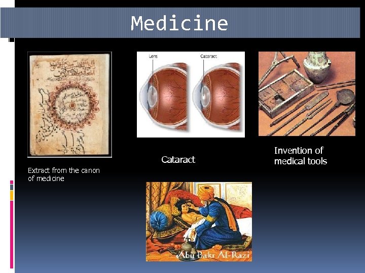 Medicine Cataract Extract from the canon of medicine Invention of medical tools 