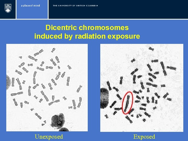 Dicentric chromosomes induced by radiation exposure Unexposed Exposed 