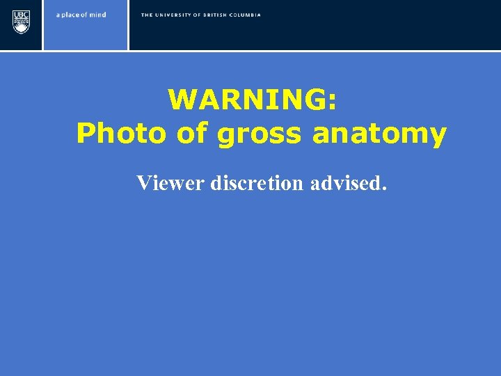 WARNING: Photo of gross anatomy Viewer discretion advised. 