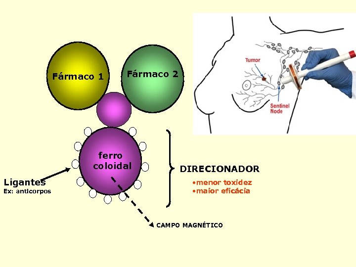 Fármaco 1 Fármaco 2 ferro coloidal Ligantes Ex: anticorpos DIRECIONADOR • menor toxidez •