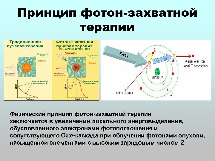 Облучение электронами. Лучевая терапия электронами. Оже терапия. Фотон терапия. Фотонно-активационная терапия.