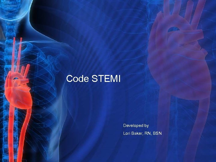 Code STEMI Developed by Lori Baker, RN, BSN 