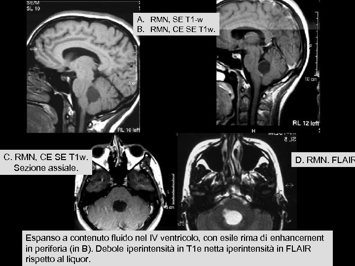 A. RMN, SE T 1 -w B. RMN, CE SE T 1 w. C.