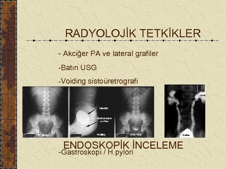 RADYOLOJİK TETKİKLER - Akciğer PA ve lateral grafiler -Batın USG -Voiding sistoüretrografi ENDOSKOPİK İNCELEME