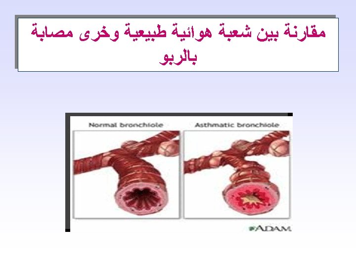  ﻣﻘﺎﺭﻧﺔ ﺑﻴﻦ ﺷﻌﺒﺔ ﻫﻮﺍﺋﻴﺔ ﻃﺒﻴﻌﻴﺔ ﻭﺧﺮﻯ ﻣﺼﺎﺑﺔ ﺑﺎﻟﺮﺑﻮ 