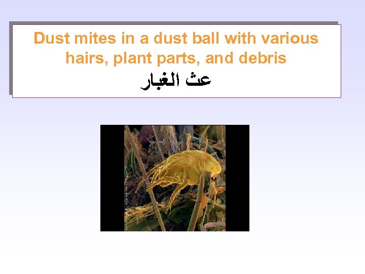 Dust mites in a dust ball with various hairs, plant parts, and debris ﻋﺚ