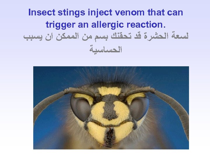Insect stings inject venom that can trigger an allergic reaction. ﻟﺴﻌﺔ ﺍﻟﺤﺸﺮﺓ ﻗﺪ ﺗﺤﻘﻨﻚ