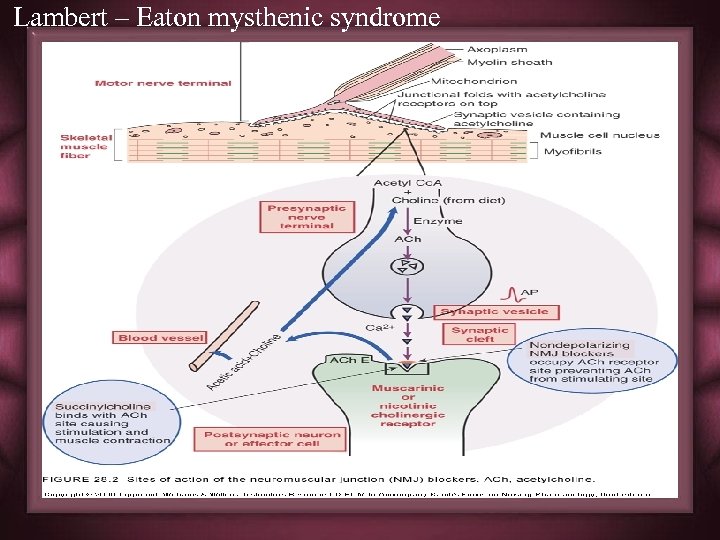 Lambert – Eaton mysthenic syndrome 