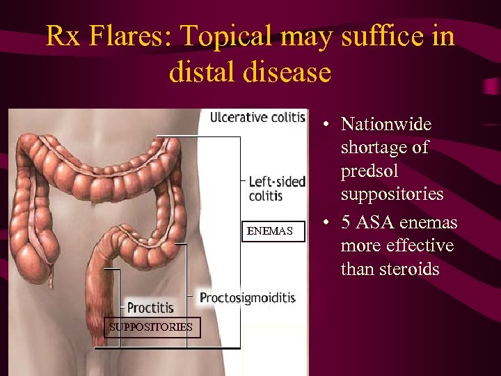 Rx Flares: Topical may suffice in distal disease ENEMAS SUPPOSITORIES • Nationwide shortage of