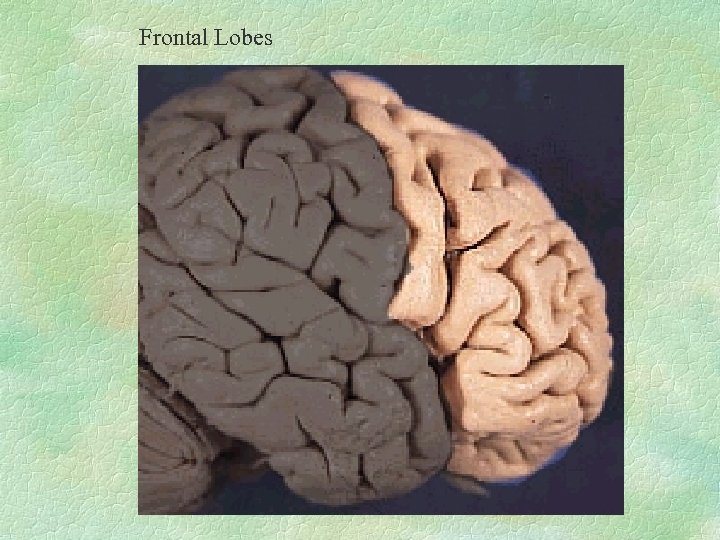 Frontal Lobes 
