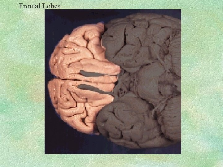 Frontal Lobes 