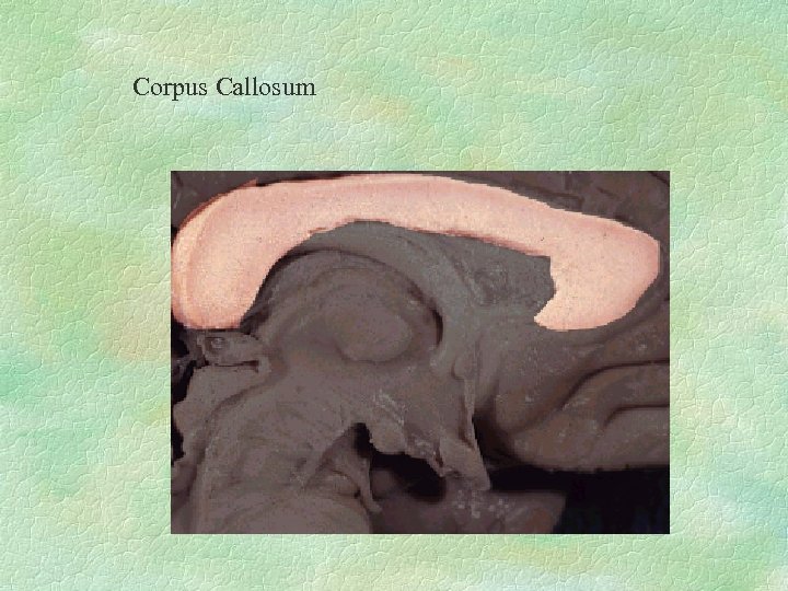 Corpus Callosum 