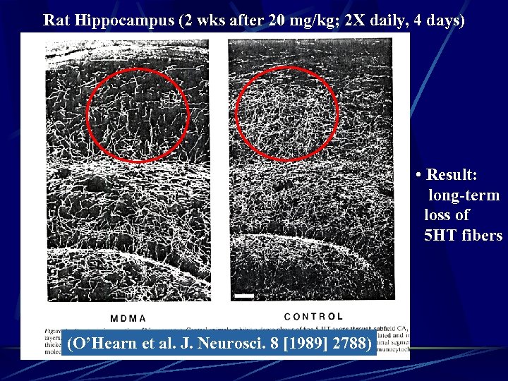 Rat Hippocampus (2 wks after 20 mg/kg; 2 X daily, 4 days) • Result: