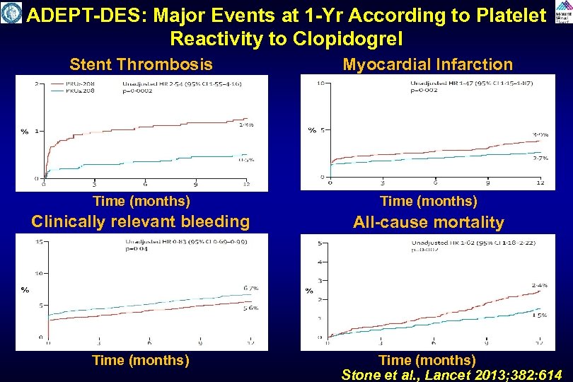 ADEPT-DES: Major Events at 1 -Yr According to Platelet Reactivity to Clopidogrel Stent Thrombosis