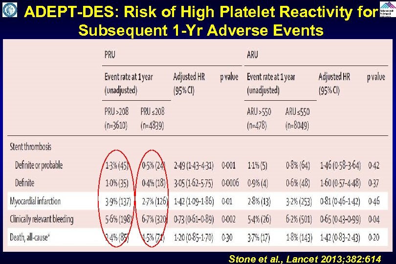 ADEPT-DES: Risk of High Platelet Reactivity for Subsequent 1 -Yr Adverse Events Stone et