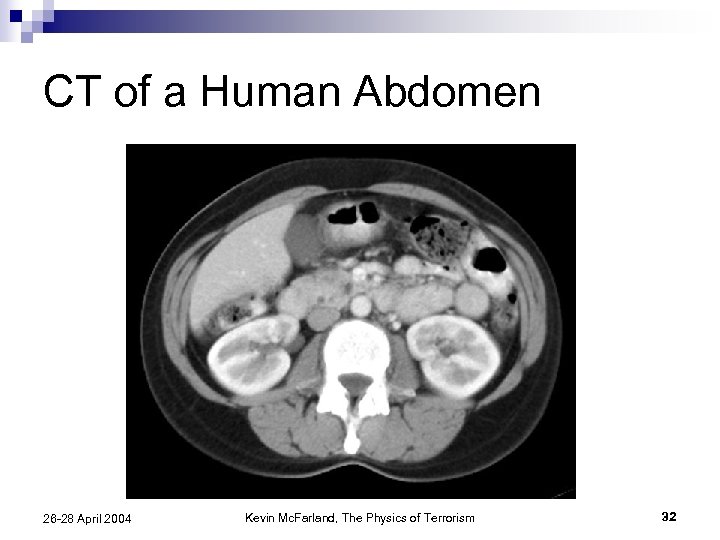 CT of a Human Abdomen 26 -28 April 2004 Kevin Mc. Farland, The Physics