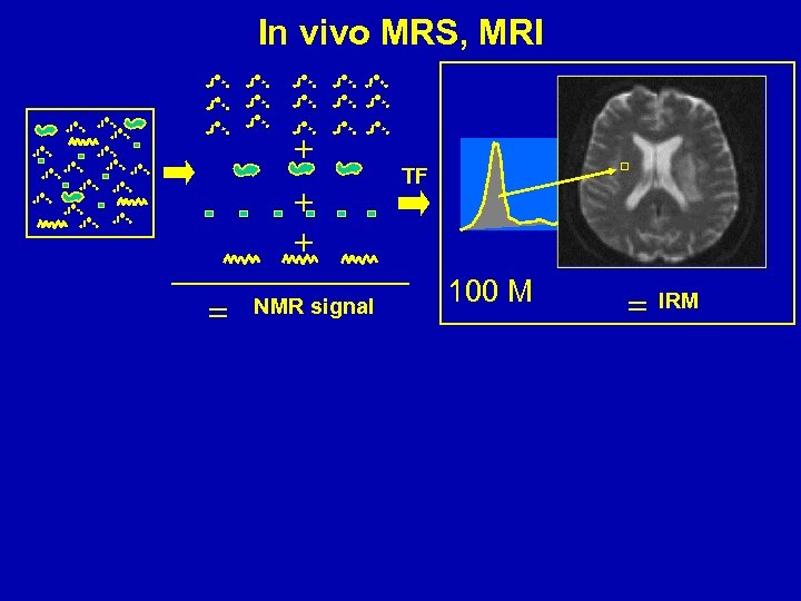 In vivo MRS, MRI NMR signal TF 100 M IRM 