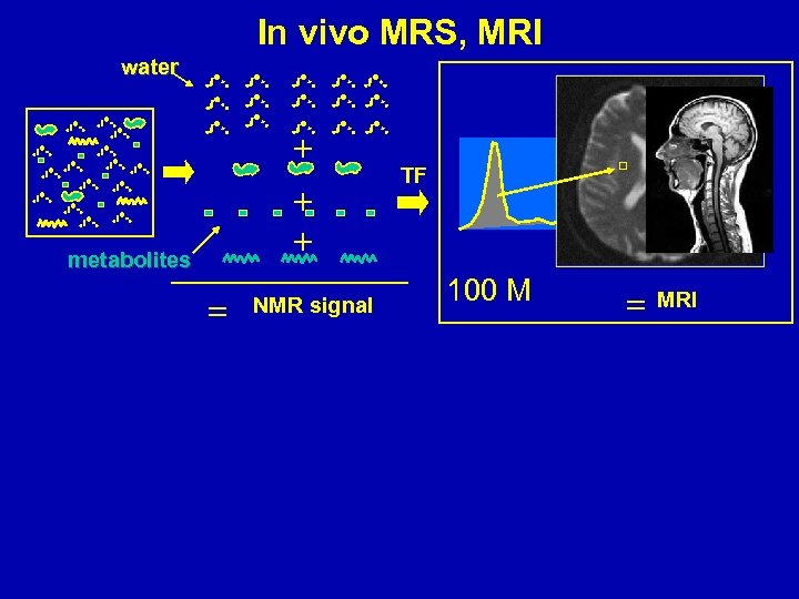 In vivo MRS, MRI water metabolites NMR signal TF 100 M MRI 