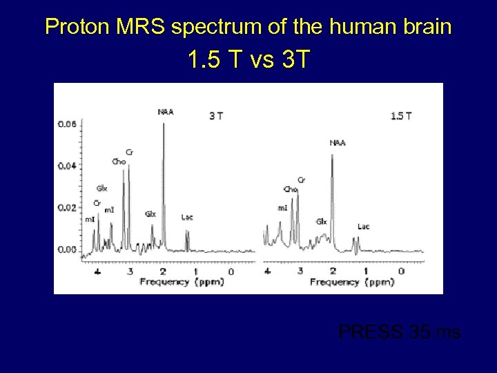 Proton MRS spectrum of the human brain 1. 5 T vs 3 T PRESS