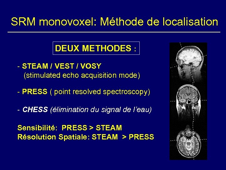 SRM monovoxel: Méthode de localisation DEUX METHODES : - STEAM / VEST / VOSY