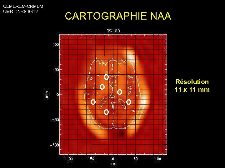 CEMEREM-CRMBM UMR CNRS 6612 CARTOGRAPHIE NAA Résolution 11 x 11 mm 