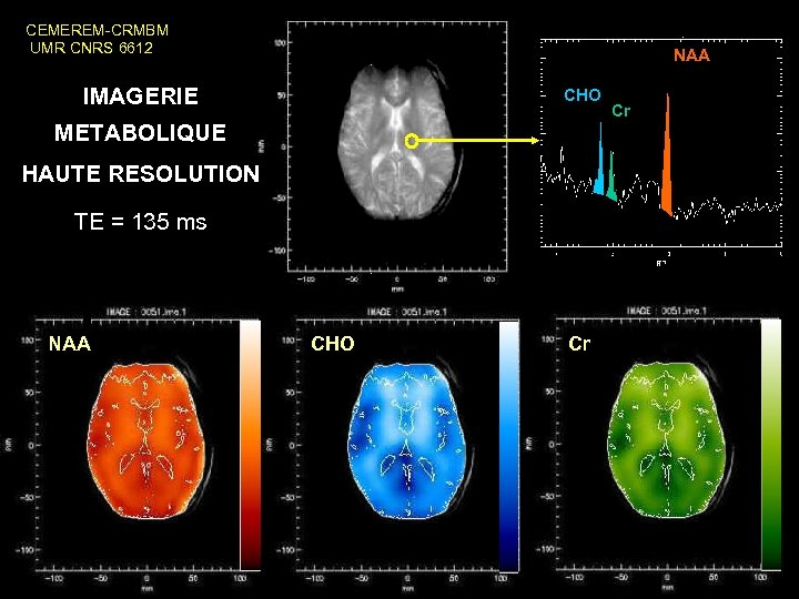 CEMEREM-CRMBM UMR CNRS 6612 NAA IMAGERIE CHO METABOLIQUE HAUTE RESOLUTION TE = 135 ms