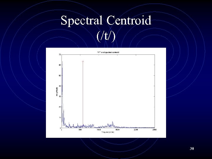 Spectral Centroid (/t/) 30 