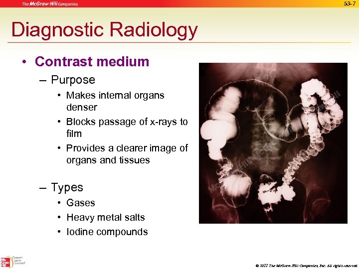 53 -7 Diagnostic Radiology • Contrast medium – Purpose • Makes internal organs denser