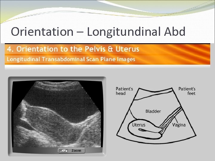 Orientation – Longitundinal Abd 