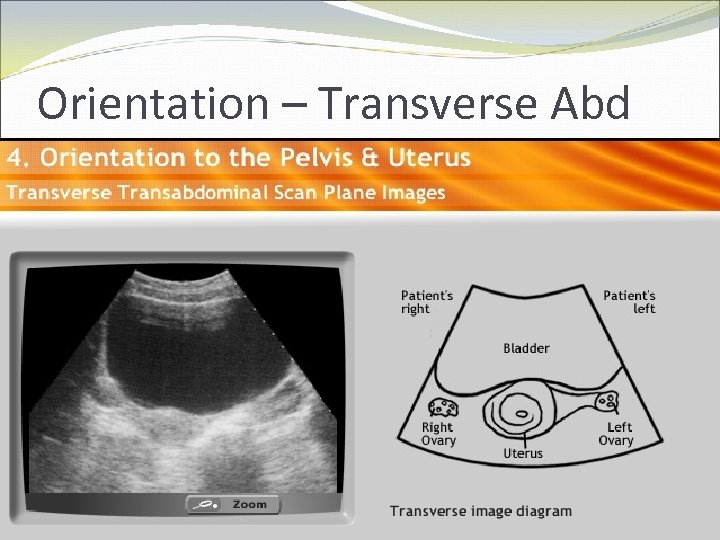 Orientation – Transverse Abd 