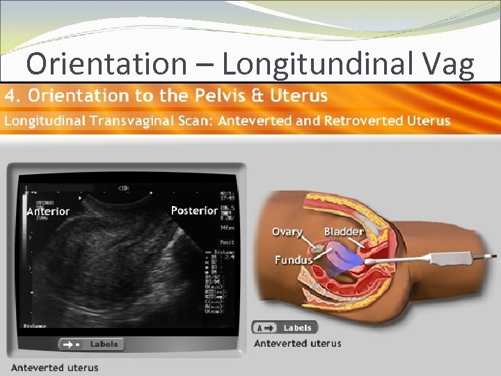 Orientation – Longitundinal Vag 