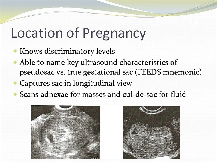 Location of Pregnancy Knows discriminatory levels Able to name key ultrasound characteristics of pseudosac